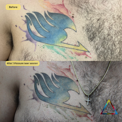 Explore mary poppins tattoo ideas, creative tattoo ideas in New York, available at Ag2g Laser Tattoo Removal & MedSpa