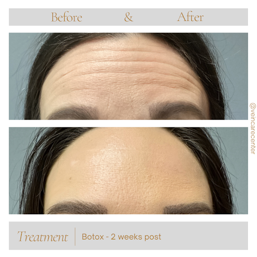 Explore realistic tattoo ideas, creative tattoo ideas in Lima, available at Vein Care Center Laser Specialists