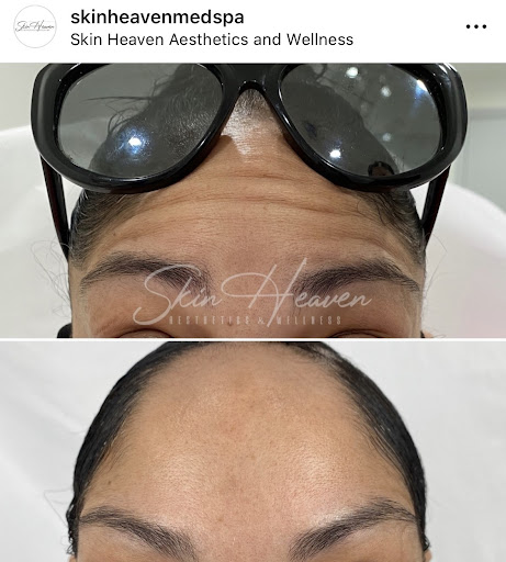 Skin Heaven Aesthetics and Wellness image