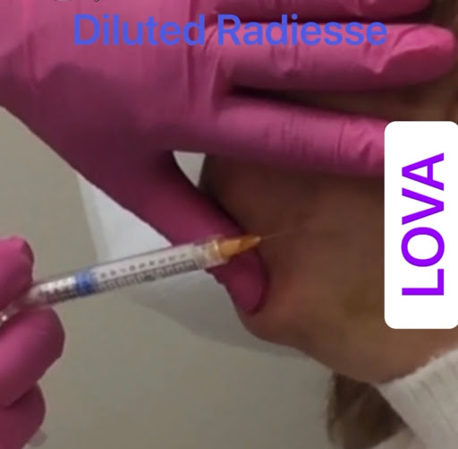 Explore pisces fish tattoo ideas, creative tattoo ideas in Lake Oswego, available at Lake Oswego Vein and Aesthetic LOVA