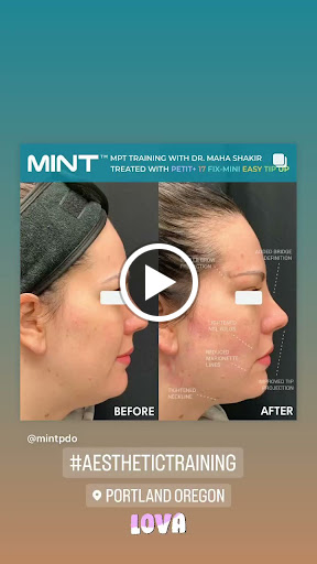 Explore simple bat tattoo ideas, creative tattoo ideas in Lake Oswego, available at Lake Oswego Vein and Aesthetic LOVA