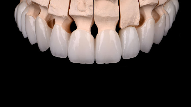 Opinii despre RESTORE Dental Lab în <nil> - Dentist