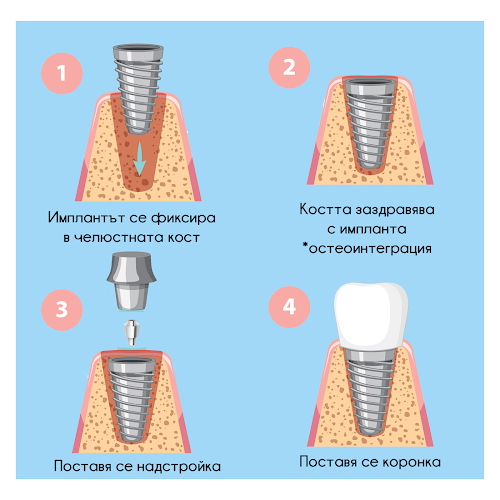 Коментари и отзиви за Стоматологичен кабинет Габрово “Rocket”/ Dental cabinet Gabrovo