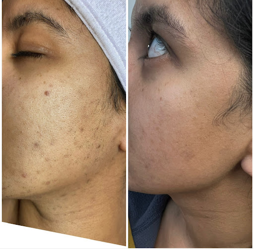 Explore shield maiden tattoo ideas, creative tattoo ideas in Tucson, available at Allure Medical