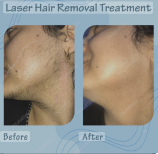 Explore cougar tattoo ideas, creative tattoo ideas in Tempe, available at Sparkle Laser HairTattoo Removal