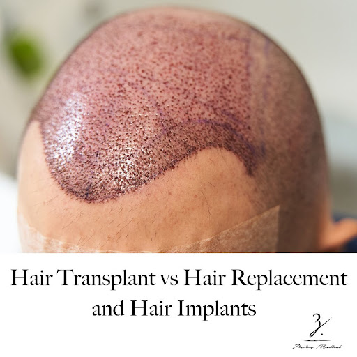 Ziering Medical Hair Restoration Beverly Hills image