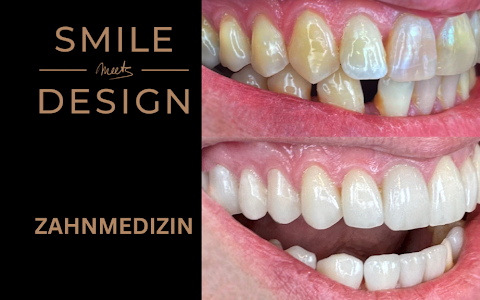 Zahnarzt Köln - SMILE MEETS DESIGN image