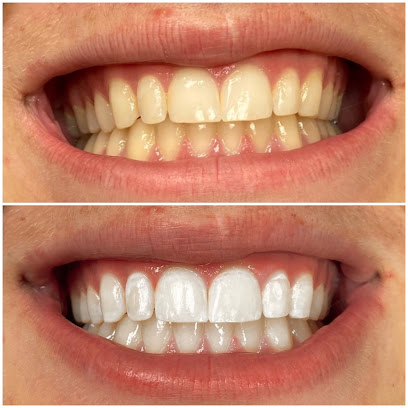 Bright White Pros Teeth Whitening