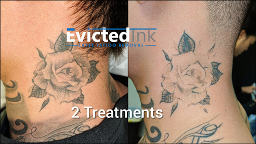 Explore forearm tattoo name ideas, creative tattoo ideas in Wichita, available at Evicted Ink Laser Tattoo Removal
