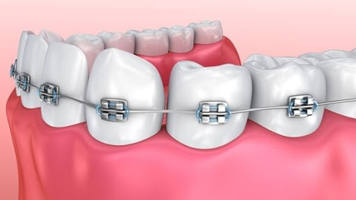 Best Dental - Family and Orthodontics