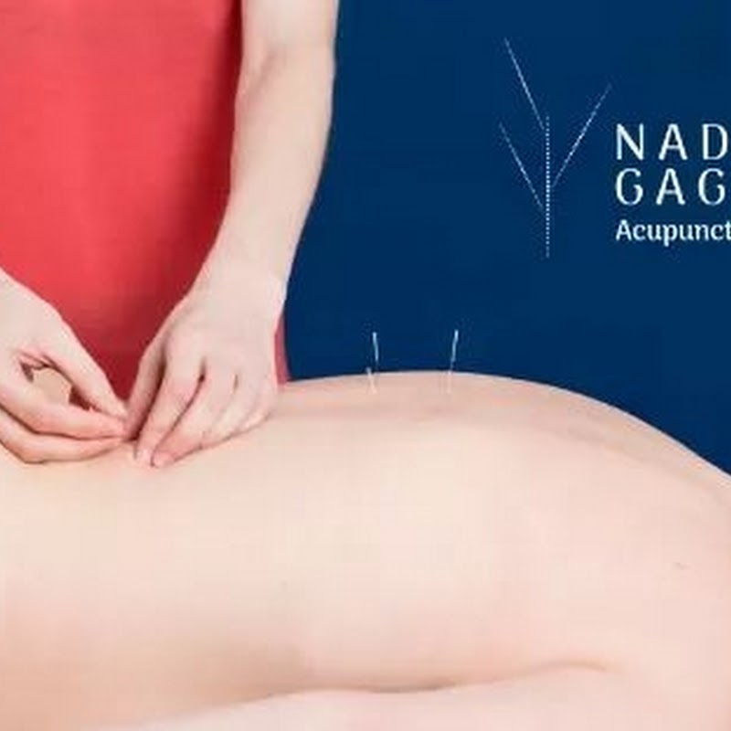 Nadia Gagnon Acupuncture