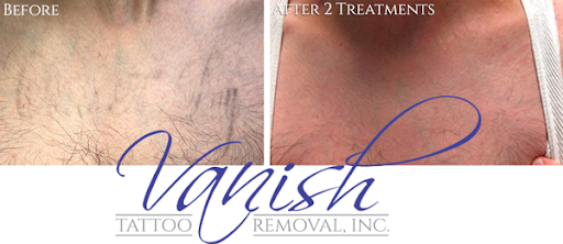 Explore man face tattoo ideas, creative tattoo ideas in Williamsport, available at Vanish Laser & Skin, Inc.