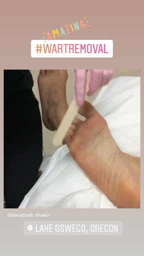 Explore tattoos xoxo ideas, creative tattoo ideas in Lake Oswego, available at Lake Oswego Vein and Aesthetic LOVA