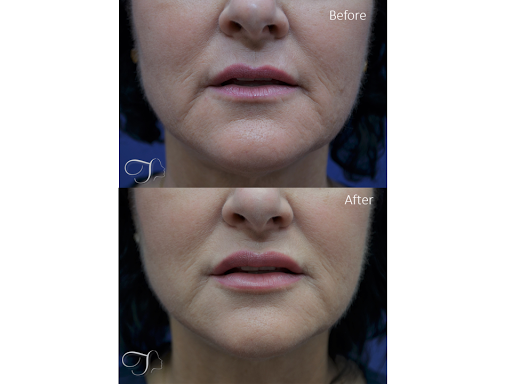 Kristina Tansavatdi, MD Tansavatdi Cosmetic & Reconstructive Surgery image