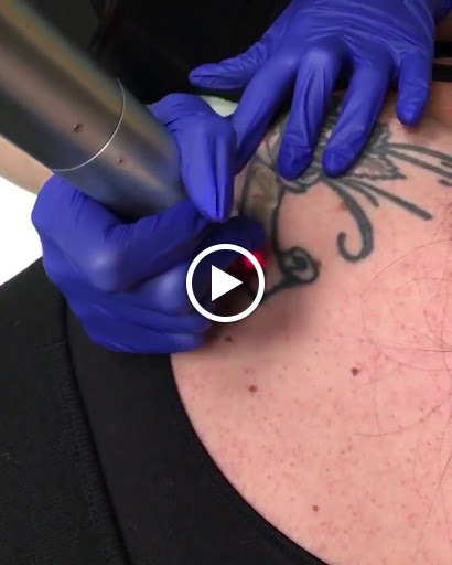 Explore armenian tattoo ideas, creative tattoo ideas in Pleasant Grove, available at Inklifters Tattoo Removal