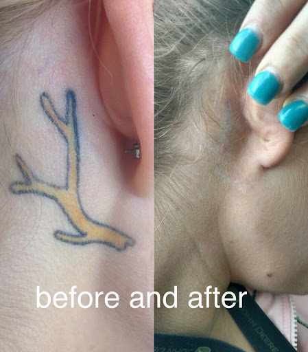 Find beach wave tattoo ideas for your next unique tattoo in Bakersfield at Bakersfield Tattoo Removal (non-laser)