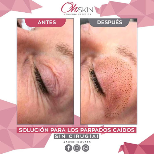 Opiniones de OhSkin Medicina Estética en Las Condes - Centro de estética