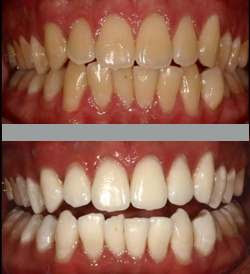 City Dental Clinic Dwarka - City Dental Clinic Dwarka