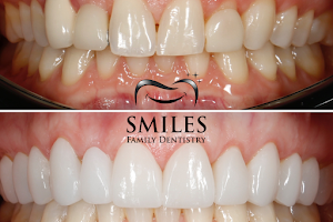 Brunswick Smiles Family Dentistry | Cosmetic, Restorative and Family Dentist in South Brunswick Township image