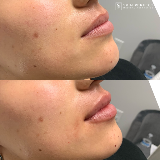 Explore ladies small tattoo ideas, creative tattoo ideas in Whittier, available at Skin Perfect Medical Aesthetics