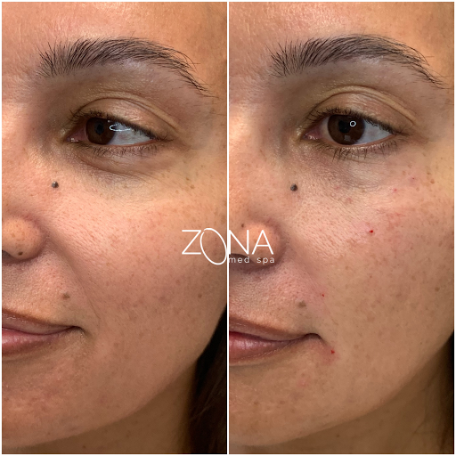 Skin Care Clinic «ZONA MED SPA», reviews and photos, 9767 N 91st St #102, Scottsdale, AZ 85258, USA