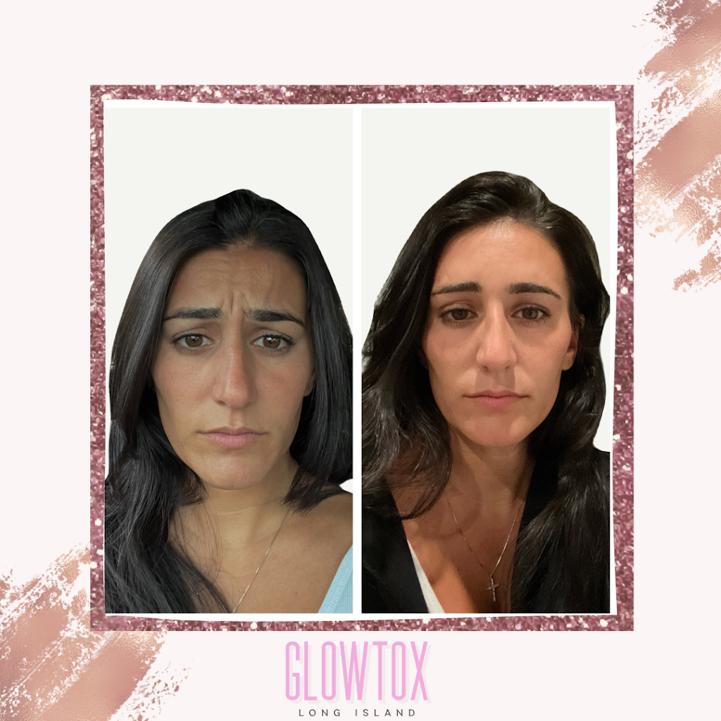 Glowtox Long Island 11753