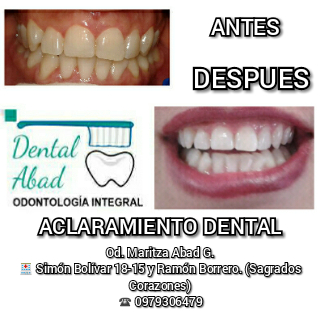 Opiniones de DENTAL ABAD en Cuenca - Dentista