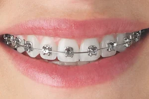 Bristles Dental Studios - Best Dentist in Chandigarh | Best Dental Clinic | Root Canal | Dental Braces Orthodontist image