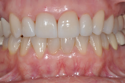 General & Cosmetic Dentistry: Dr. Kaszuba DDS