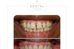 Zental Dental Bexleyheath image