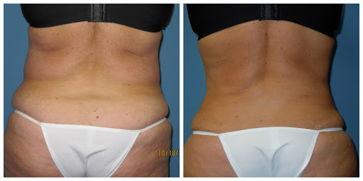 Explore red tattoo ideas, creative tattoo ideas in Coeur D Alene, available at Advanced Aesthetics Kevin Johnson, MD, FACS
