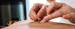 Art Of Chinese Healing | Acupuncture - Photo 8 - Car repair in Los Angeles, CA, Los Angeles