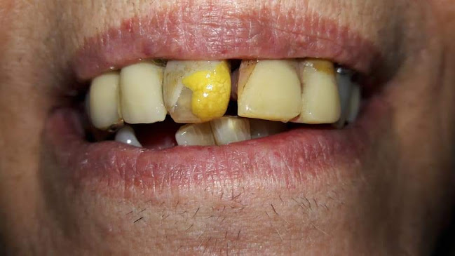 REDESCUBRI TU SONRISA COI Centro Odontologico integral - Dentista