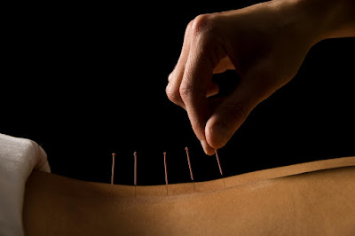 Docteur Corinne Leder, cabinet d'acupuncture et auriculothérapie à Levallois-Perret