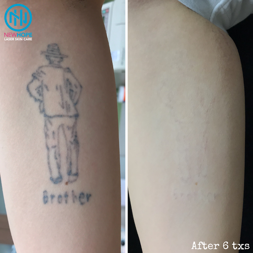 Explore thigh tattoo ideas men, creative tattoo ideas in Westminster, available at Newhope Laser Skin Care