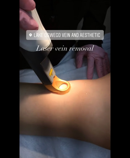 Explore hand cover up tattoo ideas, creative tattoo ideas in Lake Oswego, available at Lake Oswego Vein and Aesthetic LOVA