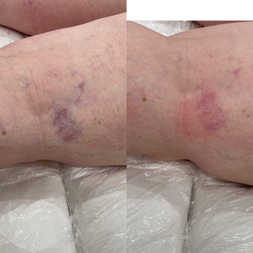 Explore metroid tattoo ideas, creative tattoo ideas in Owensboro, available at The Skin Lab