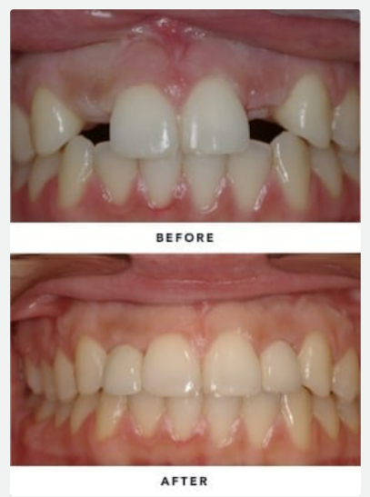 Smile Dental Implant Centre