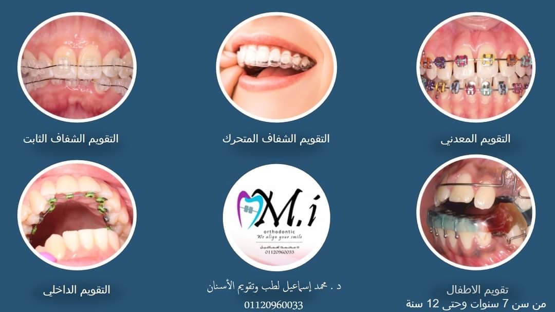 M.I Orthodontic د.محمد اسماعيل لتقويم الأسنان