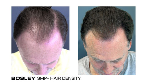 Hair Transplantation Clinic «Bosley Medical - Raleigh», reviews and photos, 4700 Falls of Neuse Rd #205, Raleigh, NC 27609, USA