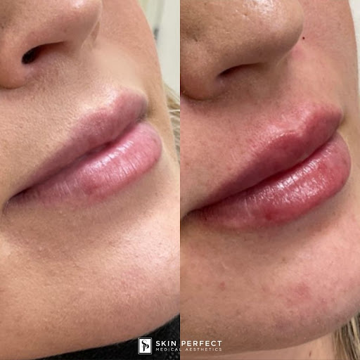 Explore tattoo sleeve drawing ideas, creative tattoo ideas in Whittier, available at Skin Perfect Medical Aesthetics