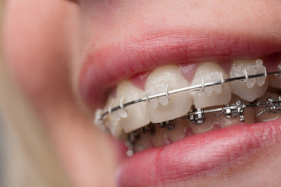 Dr. Mine SARAÇOĞLU | Ortodonti ve Implant Tedavileri