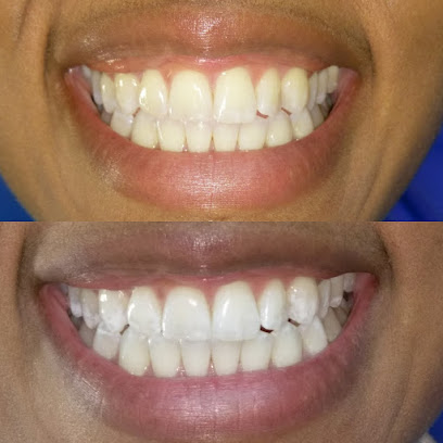 Your Perfect Smile - A Teeth Whitening Salon