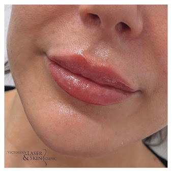 Victorian Laser & Skin Clinic - Hawthorn - Victorian Laser & Skin Clinic - Hawthorn