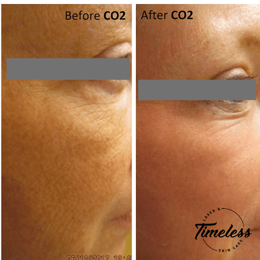 Skin Care Clinic «Timeless Laser & Skin Care», reviews and photos, 29160 Center Ridge Rd, Westlake, OH 44145, USA