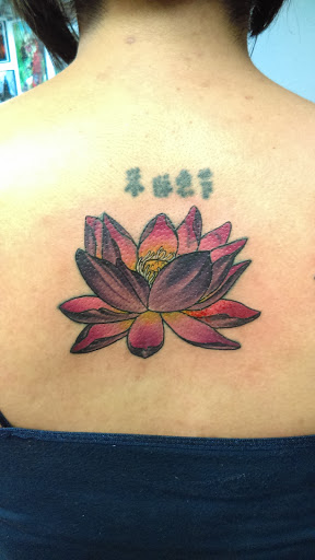 Tattoo removal service Lubbock