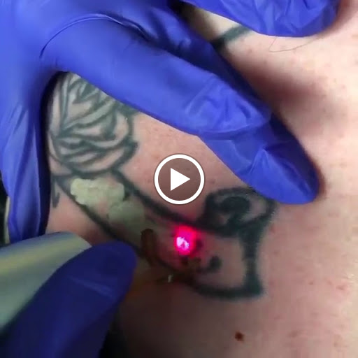 Explore devil may cry tattoo ideas, creative tattoo ideas in Pleasant Grove, available at Inklifters Tattoo Removal