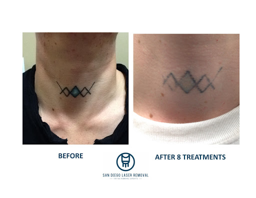 Explore vet tech tattoo ideas, creative tattoo ideas in San Diego, available at Removery Tattoo Removal & Fading