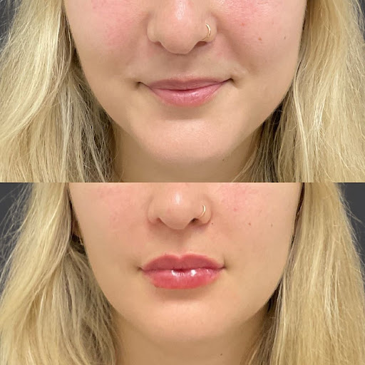 Explore ayahuasca tattoo ideas, creative tattoo ideas in Whittier, available at Skin Perfect Medical Aesthetics