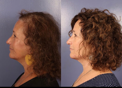 Dr. Gould Plastic Surgery image